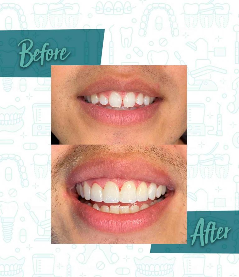 Importance of scheduling routine check-ups and cleanings with a local dentist